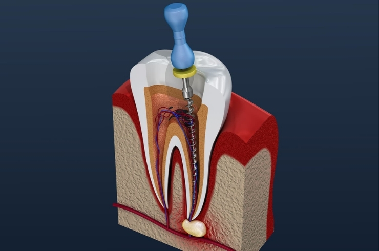 VK Dental & Facial Aesthetic Clinic